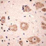 Lamp1 Antibody in Immunohistochemistry (Paraffin) (IHC (P))