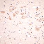 Lamp1 Antibody in Immunohistochemistry (Paraffin) (IHC (P))