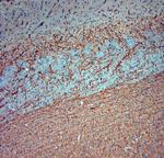 MAP2 Antibody in Immunohistochemistry (Paraffin) (IHC (P))