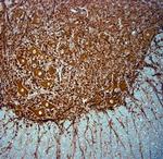 MAP2 Antibody in Immunohistochemistry (Paraffin) (IHC (P))