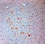 Mortalin Antibody in Immunohistochemistry (Paraffin) (IHC (P))