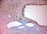 Mortalin Antibody in Immunohistochemistry (Paraffin) (IHC (P))