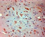 Mortalin Antibody in Immunohistochemistry (Paraffin) (IHC (P))