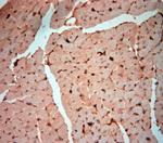 NG2 Antibody in Immunohistochemistry (Paraffin) (IHC (P))