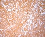 NG2 Antibody in Immunohistochemistry (Paraffin) (IHC (P))