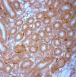 NG2 Antibody in Immunohistochemistry (Paraffin) (IHC (P))