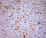 NG2 Antibody in Immunohistochemistry (Paraffin) (IHC (P))