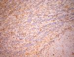 NG2 Antibody in Immunohistochemistry (Paraffin) (IHC (P))