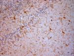 NG2 Antibody in Immunohistochemistry (Paraffin) (IHC (P))