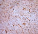 NG2 Antibody in Immunohistochemistry (Paraffin) (IHC (P))