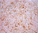 NG2 Antibody in Immunohistochemistry (Paraffin) (IHC (P))