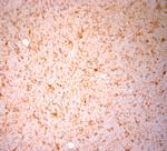 NG2 Antibody in Immunohistochemistry (Paraffin) (IHC (P))