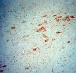 nNOS Antibody in Immunohistochemistry (Paraffin) (IHC (P))