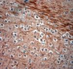 200 Neurofilament Antibody in Immunohistochemistry (Paraffin) (IHC (P))