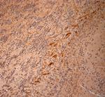 200 Neurofilament Antibody in Immunohistochemistry (Paraffin) (IHC (P))