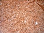 200 Neurofilament Antibody in Immunohistochemistry (Paraffin) (IHC (P))