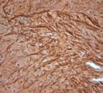 200 Neurofilament Antibody in Immunohistochemistry (Paraffin) (IHC (P))