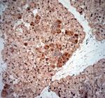 NGF Antibody in Immunohistochemistry (Paraffin) (IHC (P))