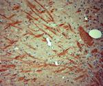 P2RX7 Antibody in Immunohistochemistry (Paraffin) (IHC (P))