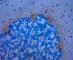 P2RX7 Antibody in Immunohistochemistry (Paraffin) (IHC (P))