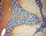 P2RX7 Antibody in Immunohistochemistry (Paraffin) (IHC (P))