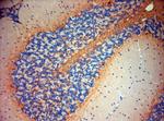 P2RX7 Antibody in Immunohistochemistry (Paraffin) (IHC (P))