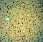 PIST Antibody in Immunohistochemistry (Paraffin) (IHC (P))