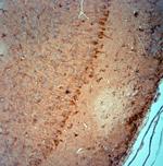 PIST Antibody in Immunohistochemistry (Paraffin) (IHC (P))