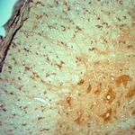 PIST Antibody in Immunohistochemistry (Paraffin) (IHC (P))