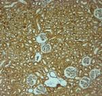 P2RY1 Antibody in Immunohistochemistry (Paraffin) (IHC (P))