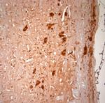 KCNH2 Antibody in Immunohistochemistry (Paraffin) (IHC (P))