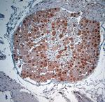 KCNH2 Antibody in Immunohistochemistry (Paraffin) (IHC (P))