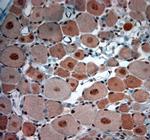 KCNH2 Antibody in Immunohistochemistry (Paraffin) (IHC (P))