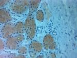 Pallidin Antibody in Immunohistochemistry (Paraffin) (IHC (P))