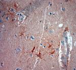 ASIC3 Antibody in Immunohistochemistry (Paraffin) (IHC (P))