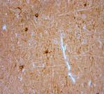 HCN2 Antibody in Immunohistochemistry (Paraffin) (IHC (P))