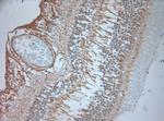 OA1 Antibody in Immunohistochemistry (Paraffin) (IHC (P))