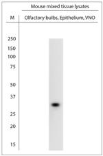 VN1B2, VN1B4 Antibody in Western Blot (WB)