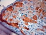 TRPV1 Antibody in Immunohistochemistry (Paraffin) (IHC (P))