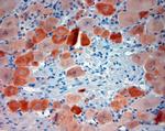 TRPV1 Antibody in Immunohistochemistry (Paraffin) (IHC (P))