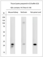 RAC1, RAC2 Antibody in Western Blot (WB)