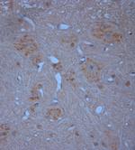 RYR1 Antibody in Immunohistochemistry (Paraffin) (IHC (P))