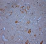 RYR1 Antibody in Immunohistochemistry (Paraffin) (IHC (P))