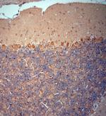 RYR1 Antibody in Immunohistochemistry (Paraffin) (IHC (P))