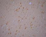 RYR1 Antibody in Immunohistochemistry (Paraffin) (IHC (P))