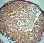 RYR1 Antibody in Immunohistochemistry (Paraffin) (IHC (P))