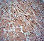 RYR1 Antibody in Immunohistochemistry (Paraffin) (IHC (P))