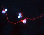 Sortilin Antibody in Immunocytochemistry (ICC/IF)