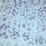 Sortilin Antibody in Immunohistochemistry (IHC)