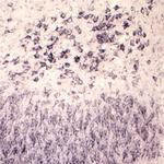 Sortilin Antibody in Immunohistochemistry (IHC)